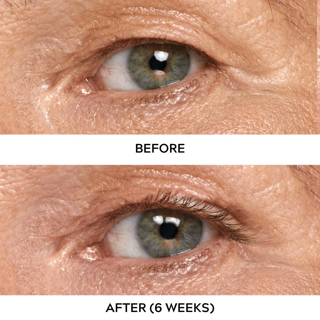 Eyelash Serum For Sensitive Eyes