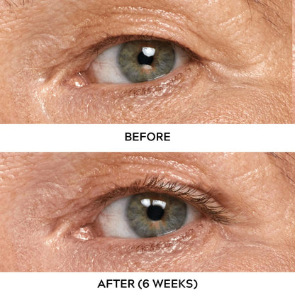 Eyelash Serum For Sensitive Eyes